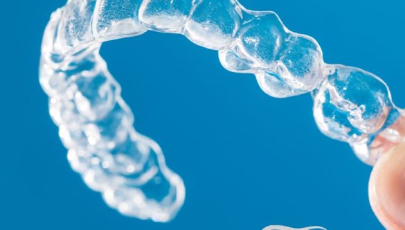 Avantages de l’Orthodontie : Pourquoi Se Lancer?