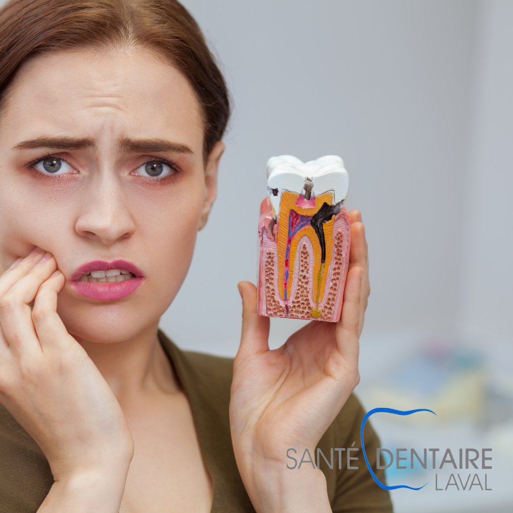 Les Caries Dentaires : Prévention, Causes et Traitements