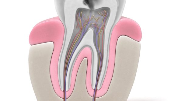 L’Endodontie : Tout Ce Que Vous Devez Savoir
